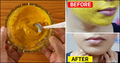 23-homemade-besan-face-packs-for-all-skin-types image