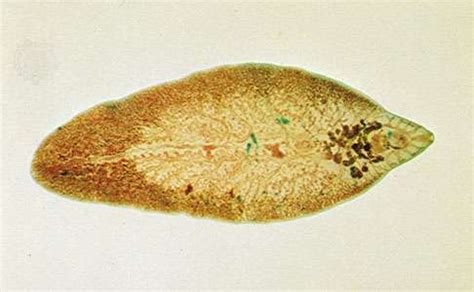 fluke-flatworm-britannica image
