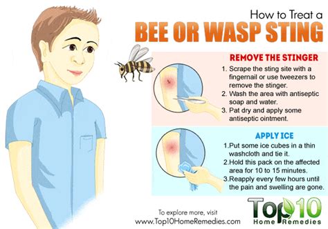 how-to-treat-a-bee-or-wasp-sting-top-10-home-remedies image