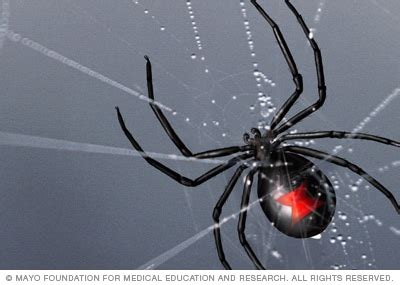 spider-bites-symptoms-and-causes-mayo-clinic image