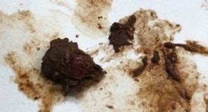 undigested-red-food-in-poops-vs-drops-of-blood image