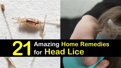 21-natural-remedies-for-head-lice-tips-bulletin image