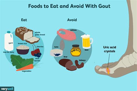 what-foods-to-eat-to-get-rid-of-gout-verywell-health image