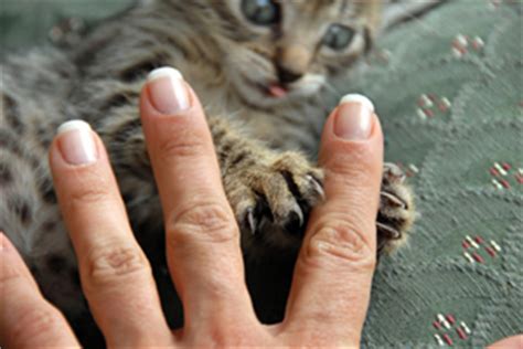 cat-scratch-disease-healthy-pets-healthy-people-cdc image