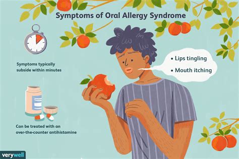 apple-allergy-symptoms-causes-foods-to-avoid-more image