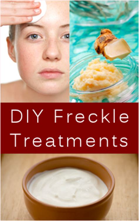 all-natural-ingredients-to-try-fading-freckles image